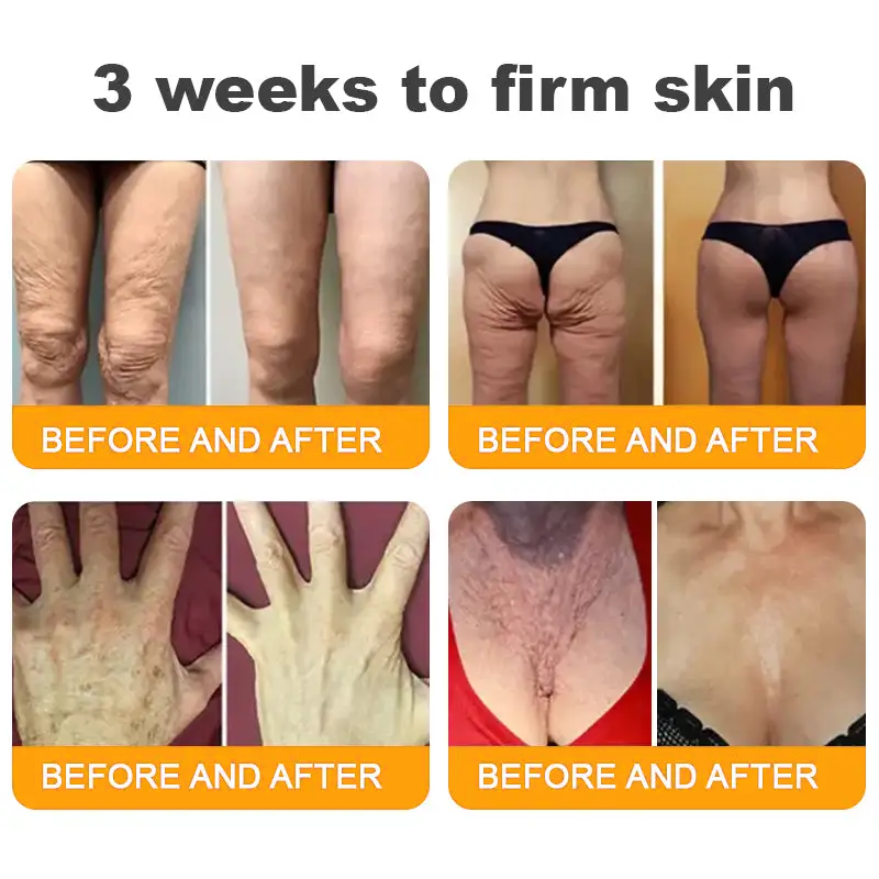 LOVILDS™ 🐝Bee Poison Skin Restoration Cream 🐝