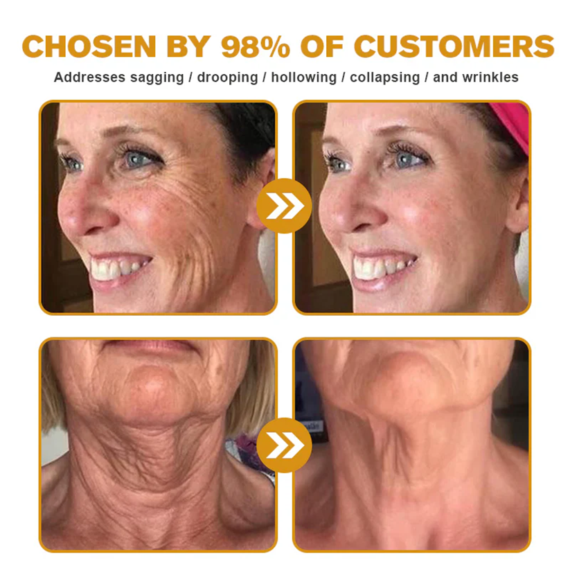 LOVILDS™ 🐝Bee Poison Skin Restoration Cream 🐝