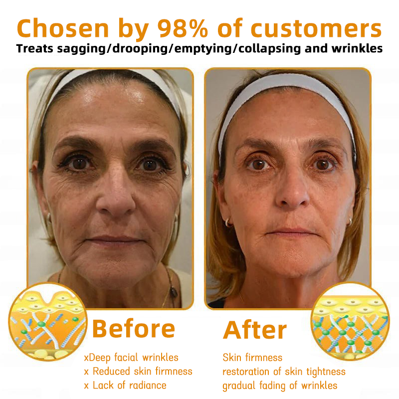 LOVILDS™ 🐝Bee Poison Skin Restoration Cream 🐝