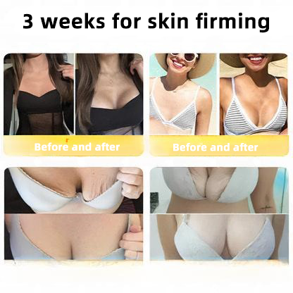 LOVILDS™ 🐝Bee Poison Skin Restoration Cream 🐝