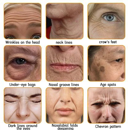 LOVILDS™ 🐝Bee Poison Skin Restoration Cream 🐝