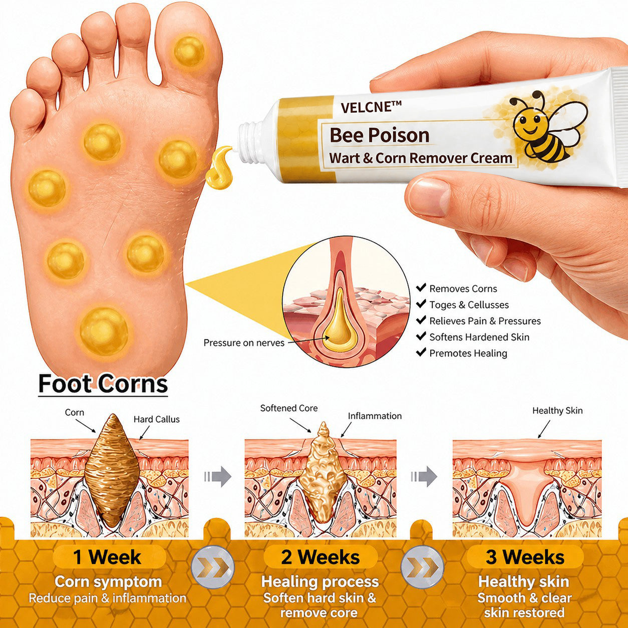 👨‍⚕️Velcne™Bee Poison Wart & Corn Remover Cream⚡