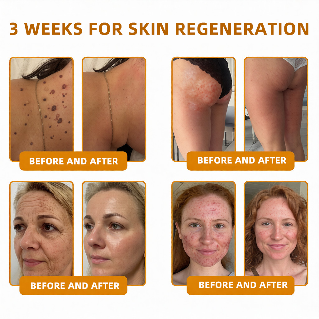 LOVILDS™ 🐝Bee Poison Skin Restoration Cream 🐝