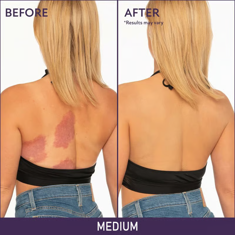 🔥Last Day 70% OFF🌟Soft Matte Cream Concealer