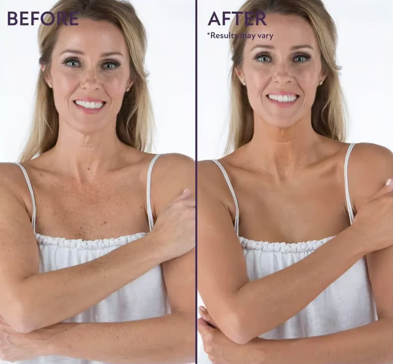 🔥Last Day 70% OFF🌟Soft Matte Cream Concealer