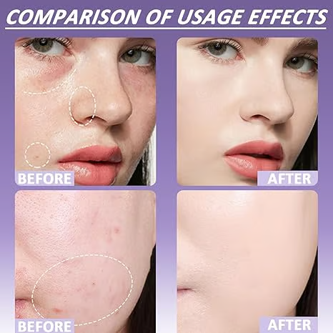 🔥Last Day 70% OFF🌟Soft Matte Cream Concealer