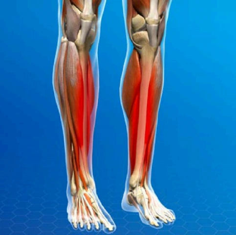 hopkinsmedicine.org/ Shin Splints (Medial Tibial Stress Syndrome) © 2017 Swarm Interactive.