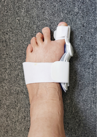 Bunion Toe Splints/Separators