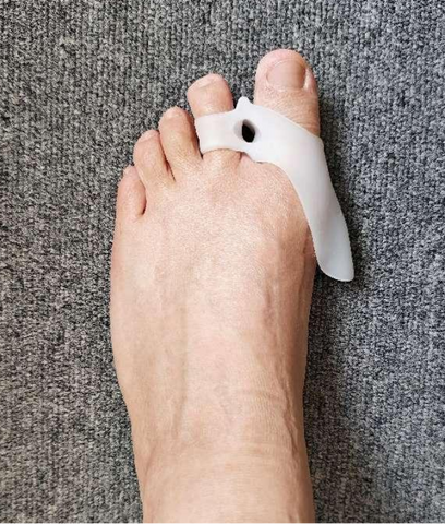 FitVille Bunion separators