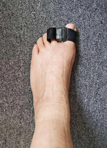 Bunion Toe Spacers/Separators