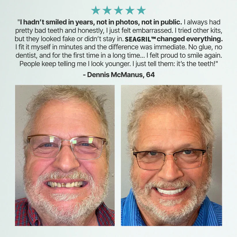 🔥Black Friday Mega Deal Save 77% - Custom-Fit Full Functional Dentures | Secure Fit | Real Comfort | Dentist-Trusted