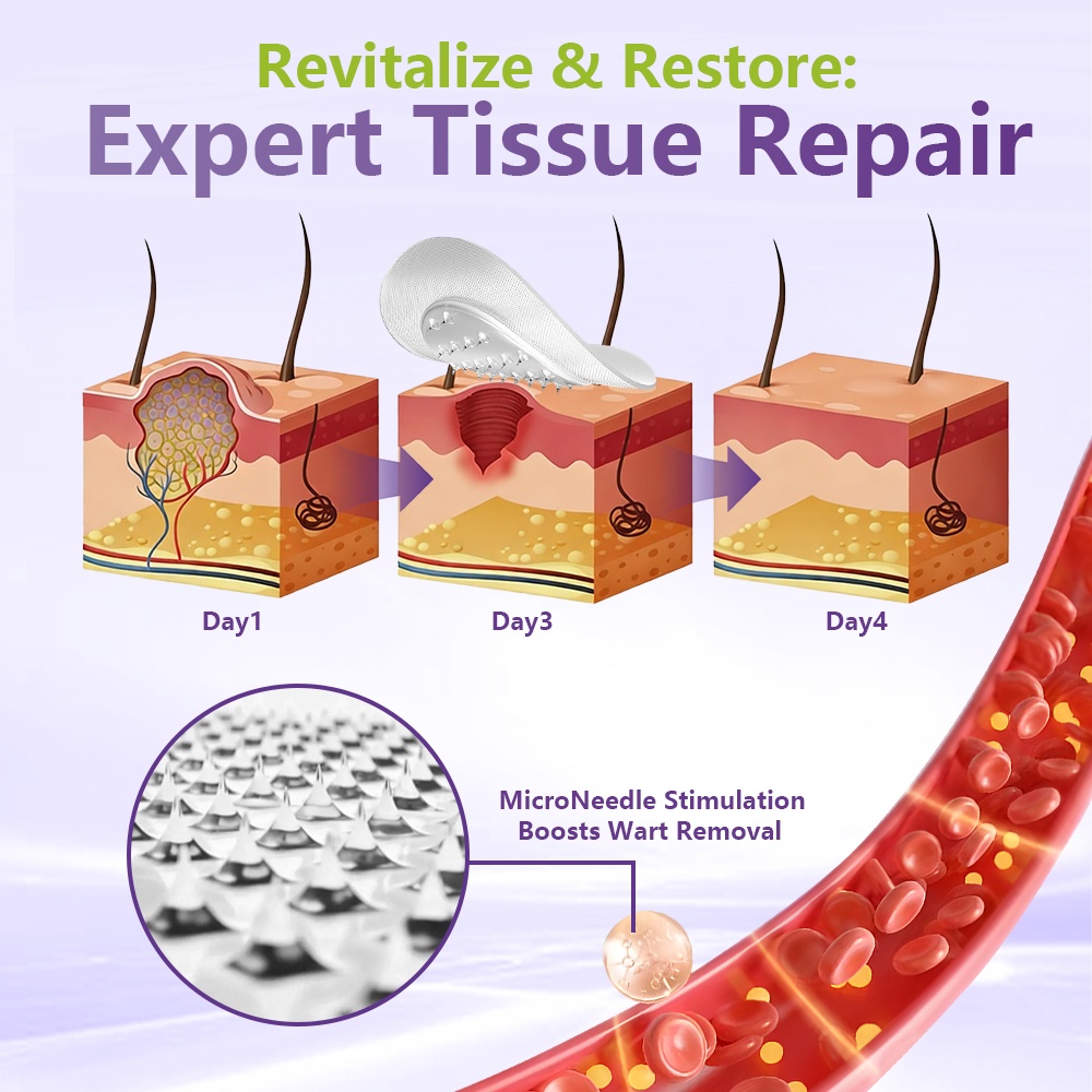 GFOUK&reg; Soluble Microneedle Botanical Skin Tag Removal Patch