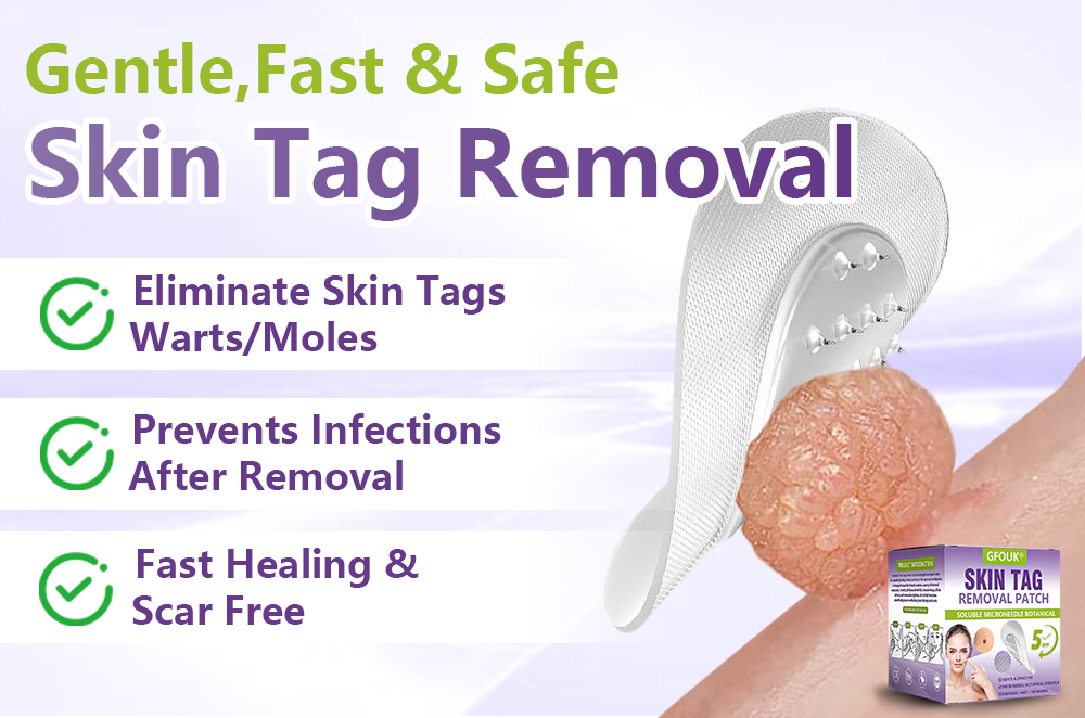 GFOUK&reg; Soluble Microneedle Botanical Skin Tag Removal Patch
