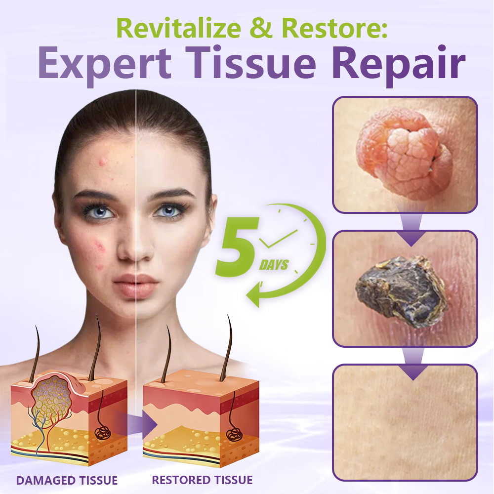 GFOUK&reg; Soluble Microneedle Botanical Skin Tag Removal Patch