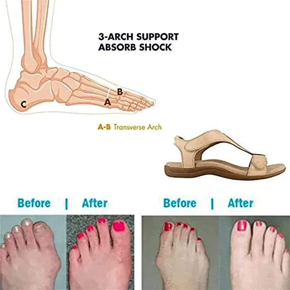 🎁LAST DAY 50% OFF🎁Women's Casual Sandals | Fit For Your Feet