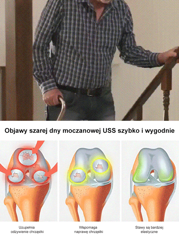 🍒Nasiona wiśni | Wyhoduj gałęzie pełne słodkich małych owoców