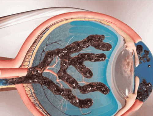c598cebe3726e389ce91bb68b19969e6.gif