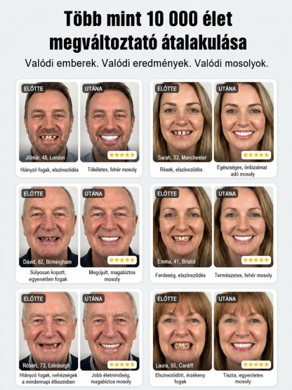 3D Bionikus Kozmetikai Fogsor - Tökéletes Mosoly és Stabil Rágás (50% OFF + Utánvét)