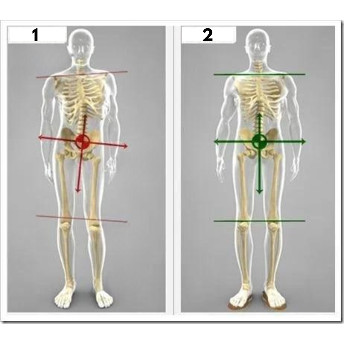 Close up of adjustable orthopedic sandal