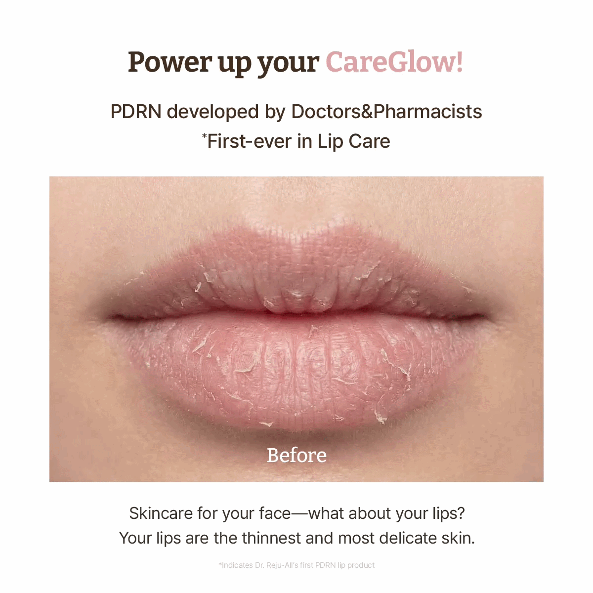 Dr.Reju-All PDRN LIP SERUM-Advanced PDRN Rejuvenating Lip Serum