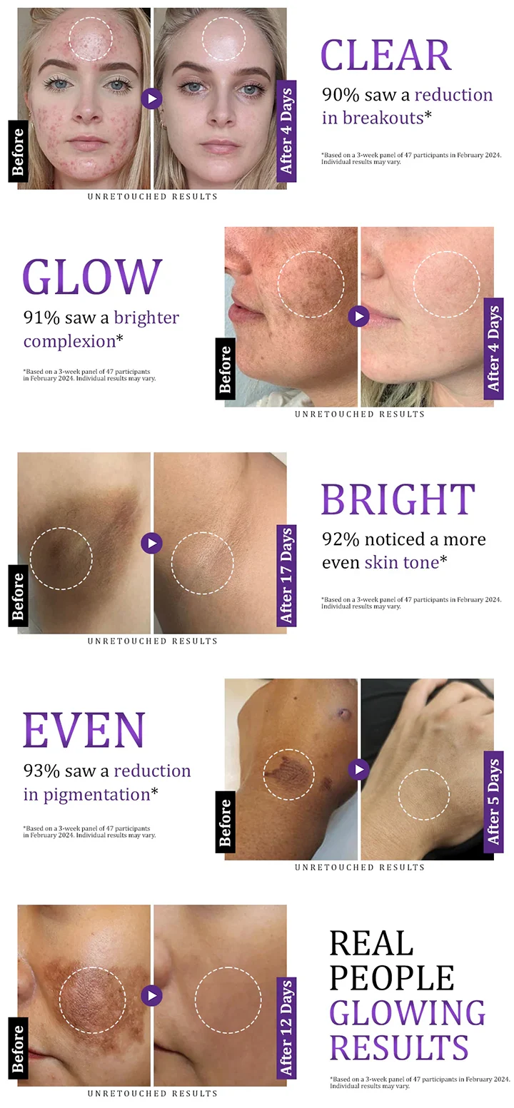 Advanced Anti Pigmentation Cream-A More Even,Looking, Radiant Complexion