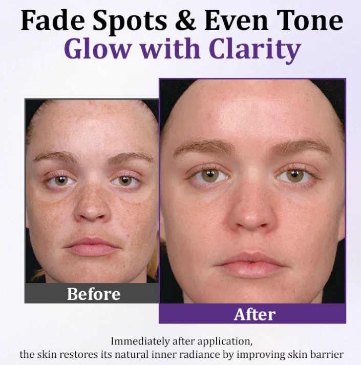 Advanced Anti Pigmentation Cream-A More Even,Looking, Radiant Complexion
