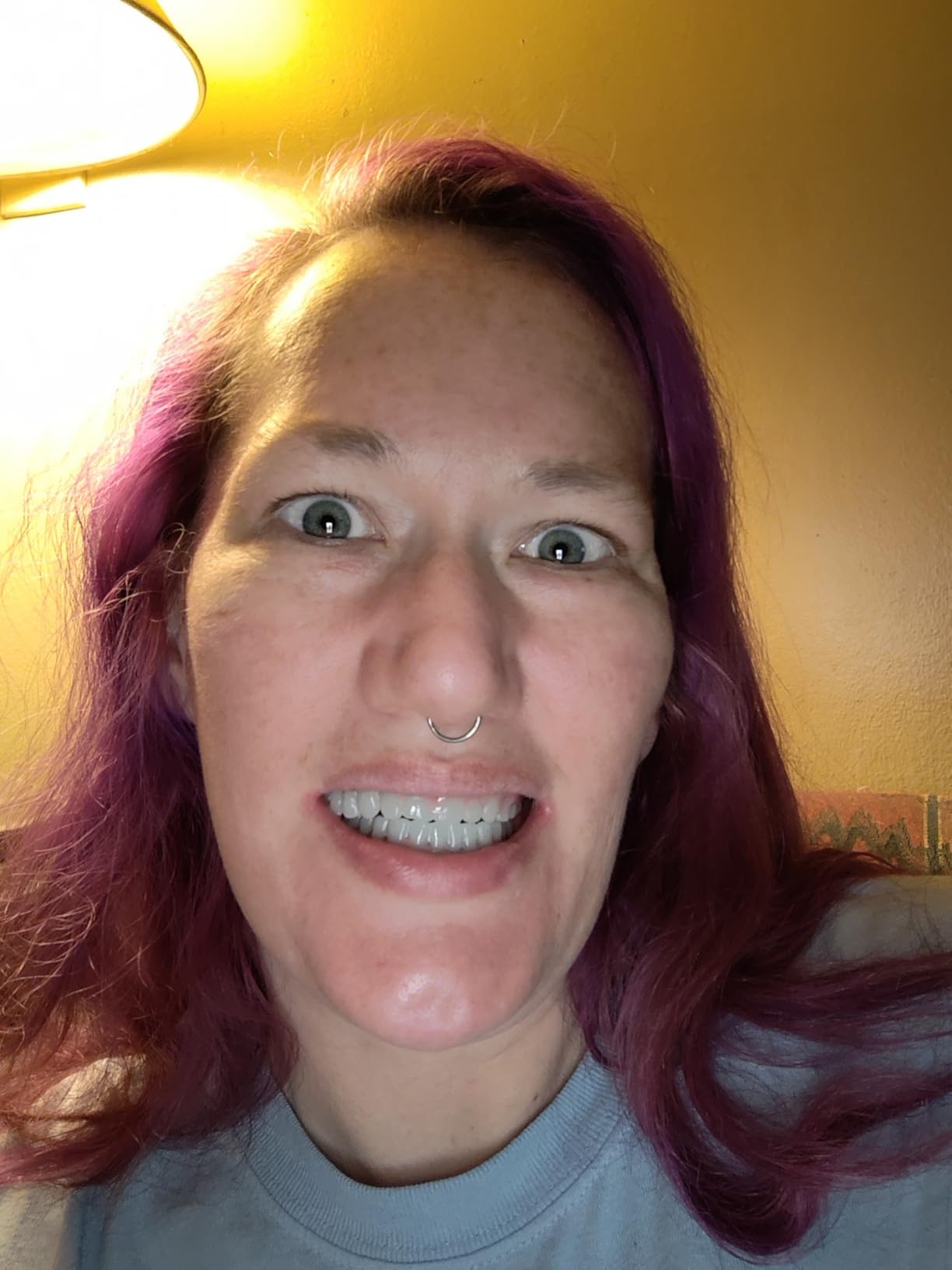 Customer denture review photo