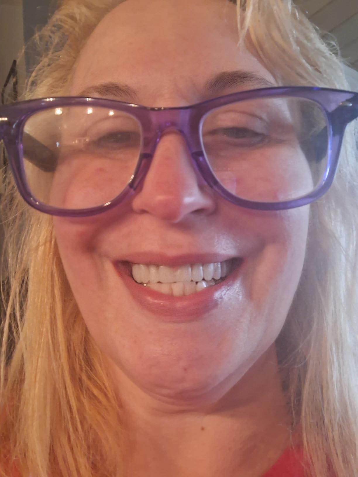 Customer denture review photo