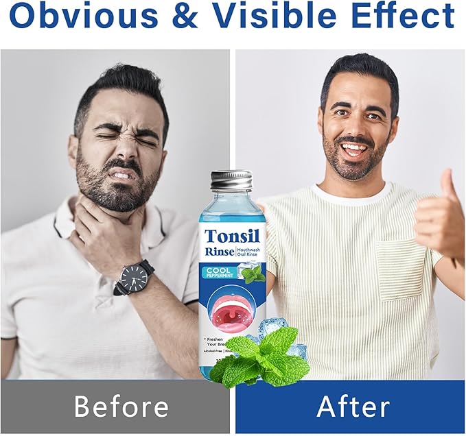 Tonsil Stone Care Mouthwash to Help Freshen Breath & Soothe Tonsils