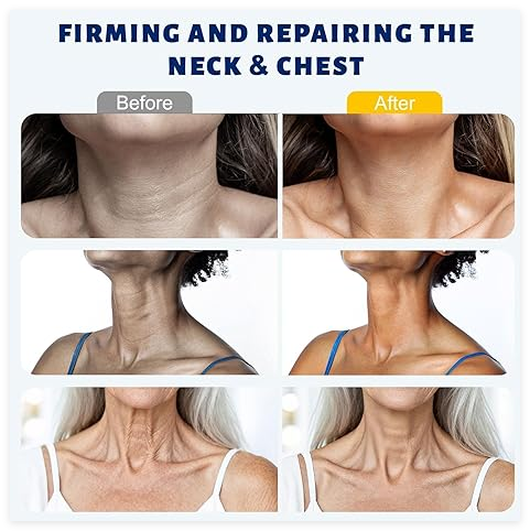 Niacinamide Neck Cream: Roller-Ball Massager for Lifting, Moisturizing, and Reducing Neck Lines