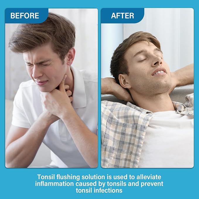 Tonsil Stone Remover