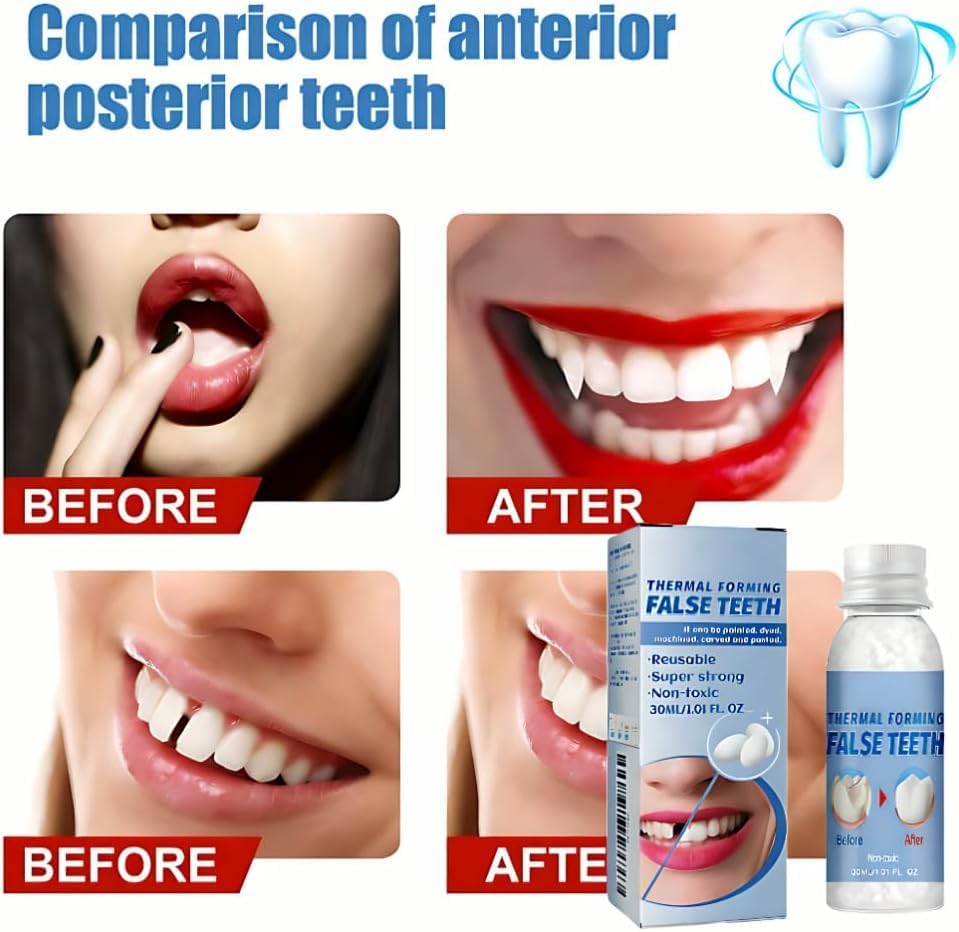 Fake Tooth Repair Kit-Thermal Beads