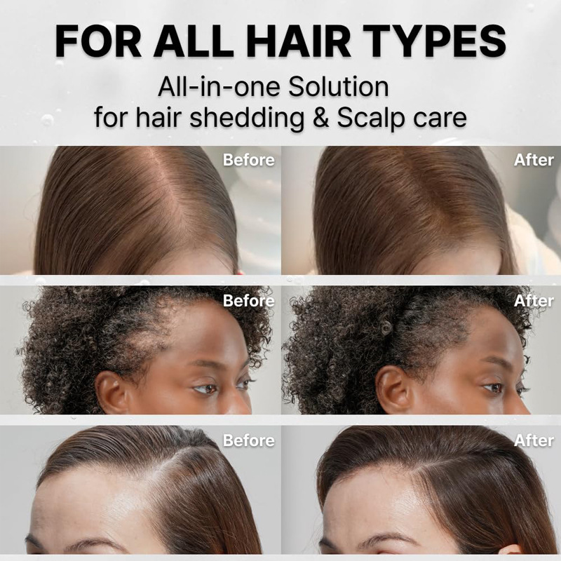 Hair Growth Serum with Built-in Brush