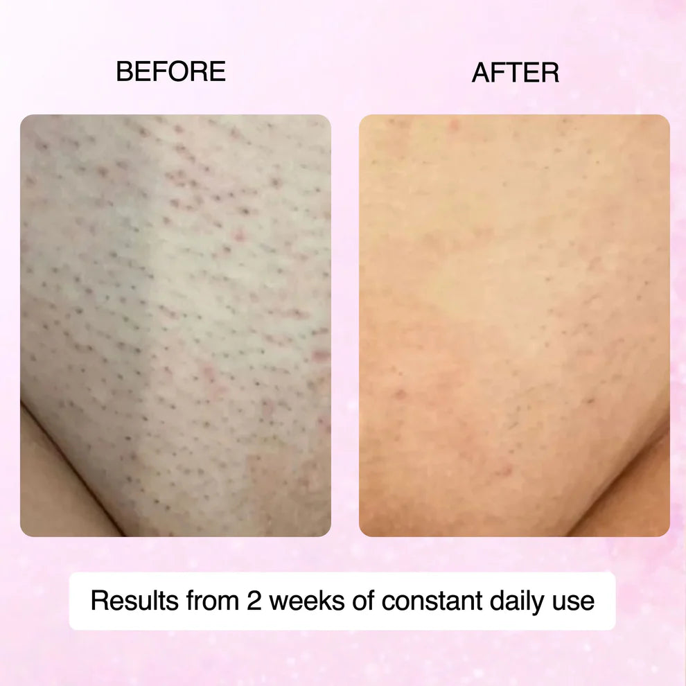 100% Natural Cyperus Rotundus Skin Serum