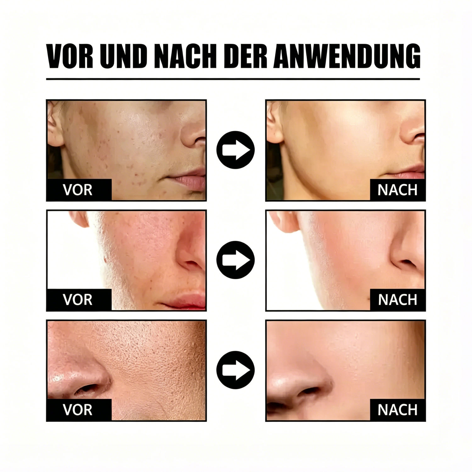 ✨2 kaufen, 2 gratis✨ Kojisäure-Kurkuma-Nachtmaske