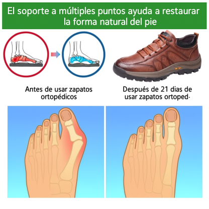 (🔥50% de descuento hoy - ¡termina hoy!) Zapatos de piel de becerro italianos suaves y cómodos 🐂 Soporte para el arco · Sin dolor al caminar durante mucho tiempo ✅ Un par para todas las ocasiones de viaje