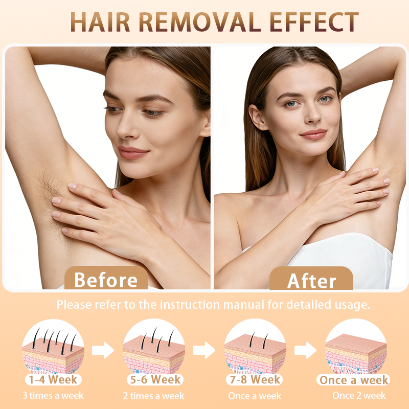 Ice-Cooling IPL Hair Removal Device – At-Home Laser Hair Removal Tool for Women, Gentle & Fast Body Hair Care, Portable Beauty Device