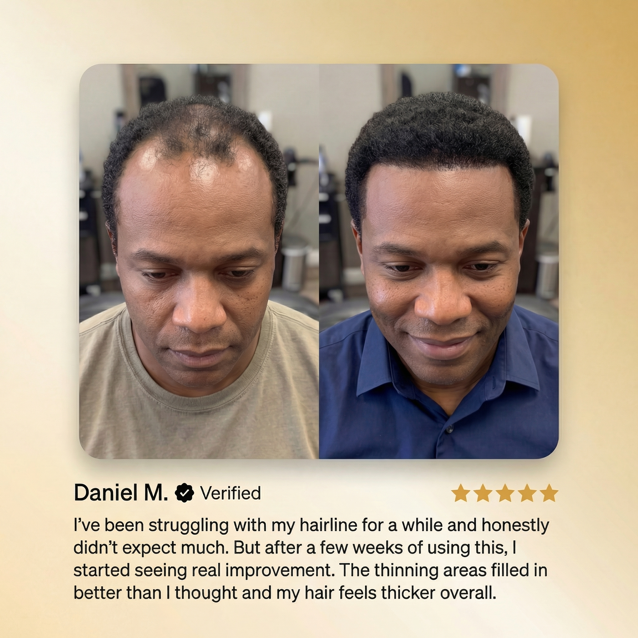Viorine Advanced Batana Hair Regrowth Therapy