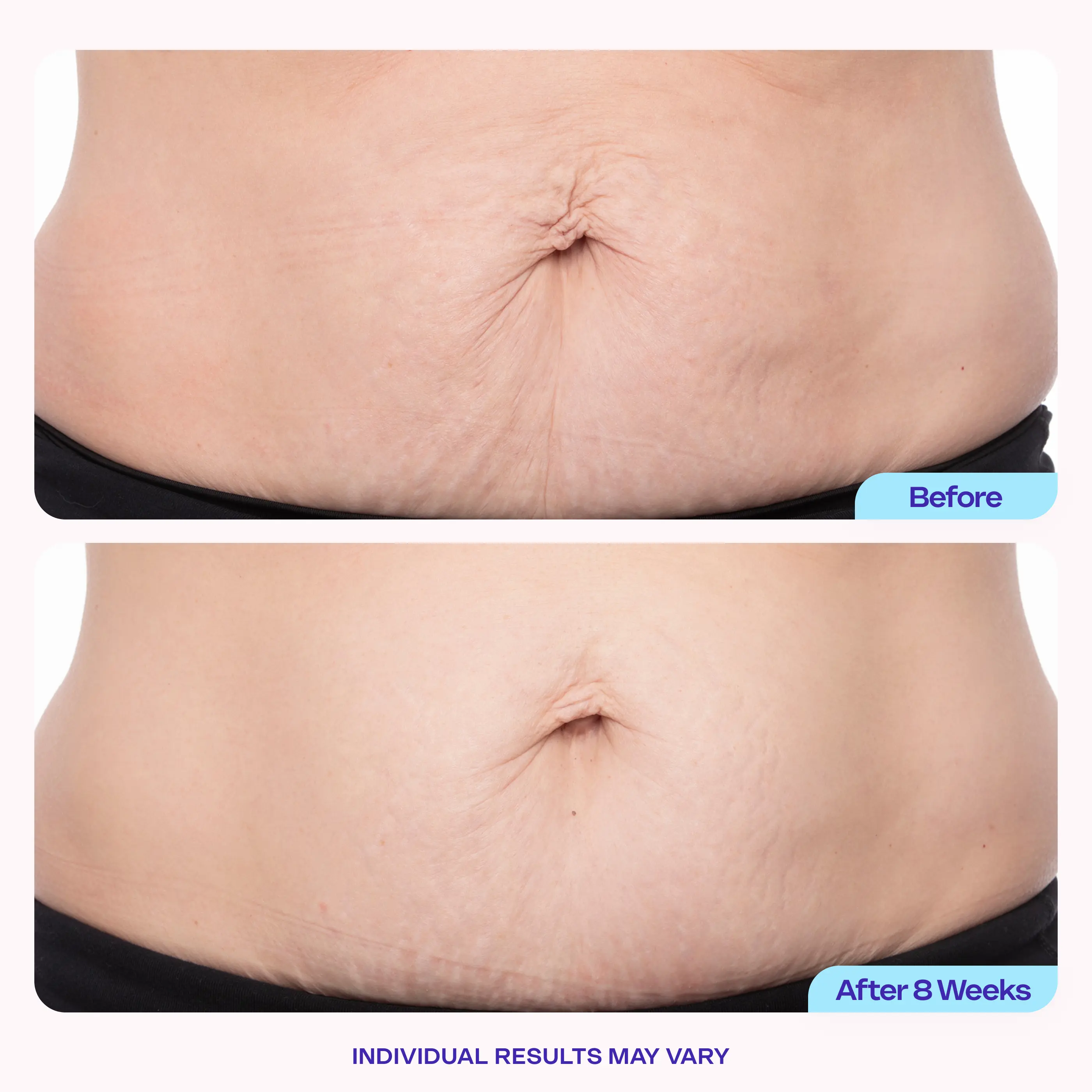  Smooth Belly Firming Cream🔥