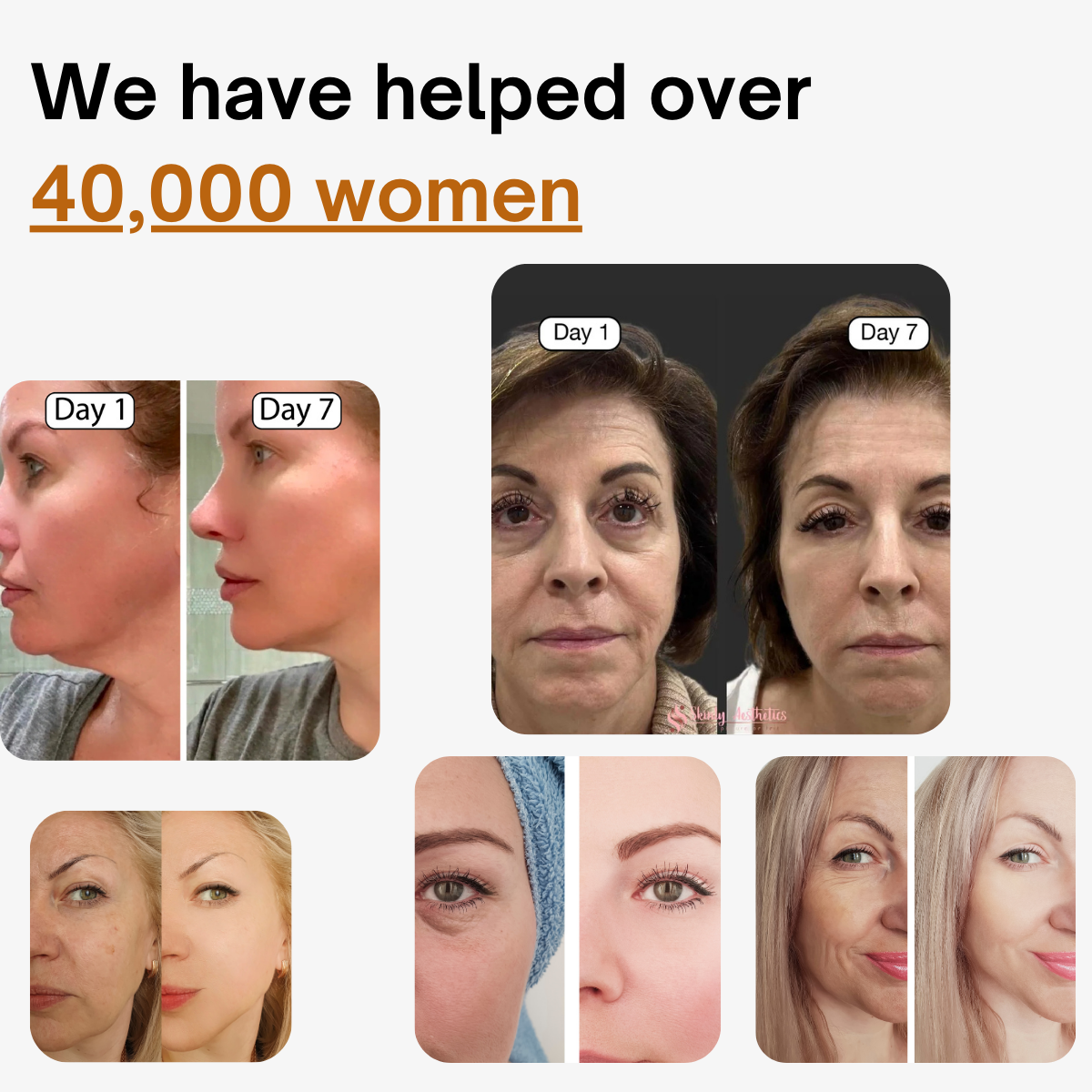 lymphatic contour face bru