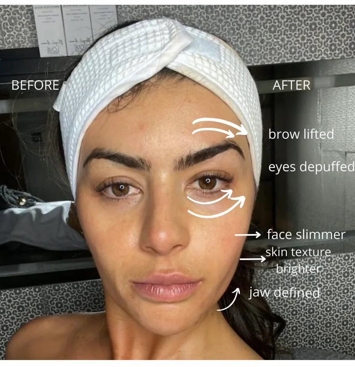 lymphatic contour face bru