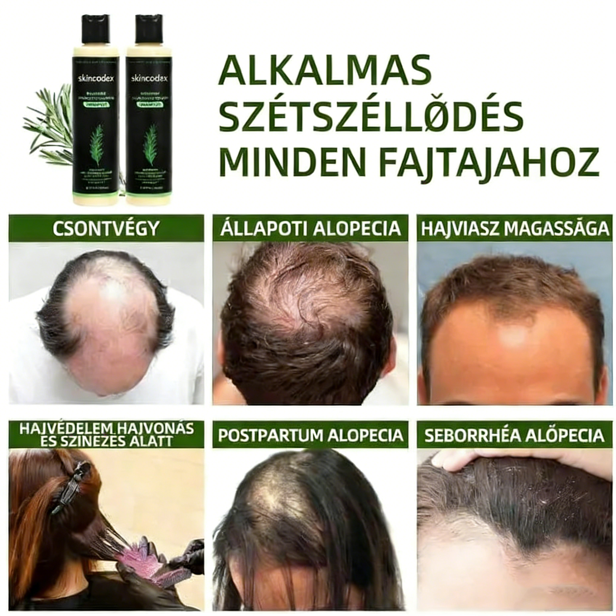 🔥LAST DAY 50% OFF - 🎅Skincodex®-Organic Rosemary Hair Growth Shampoo & Hair Conditioner