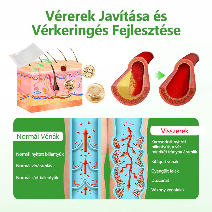 🌿Laleia® VeinHeal mikrotűs tapasz