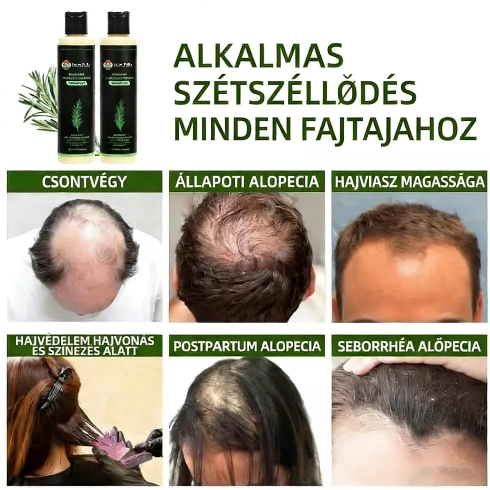 🔥UTÓS NAP 50% KEDVEZMÉNY - 🎅Skincodex® - Bio rozmaringos hajnövesztő sampon és hajbalzsam
