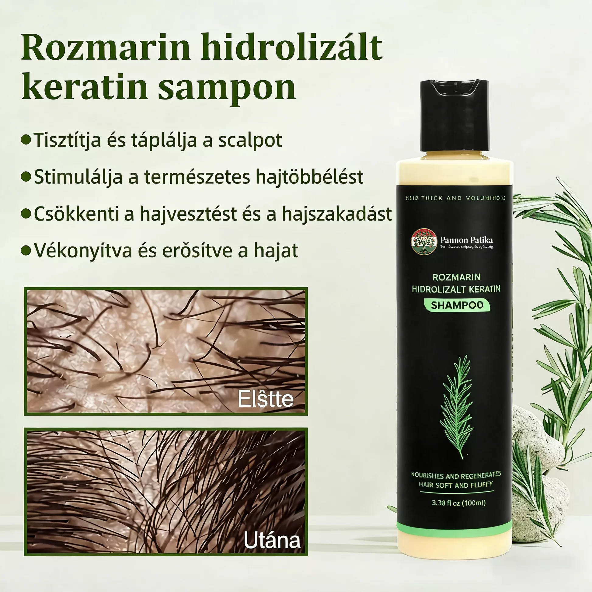 🔥UTÓS NAP 50% KEDVEZMÉNY - 🎅Skincodex® - Bio rozmaringos hajnövesztő sampon és hajbalzsam