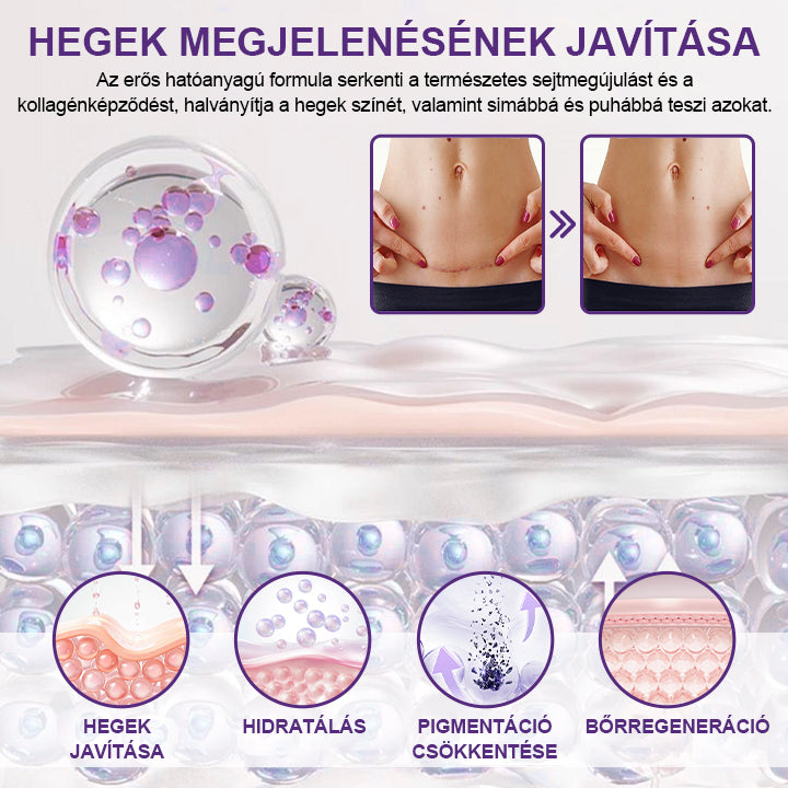 🔥🔥Laleia® ReGenScar őssejt-heg gél