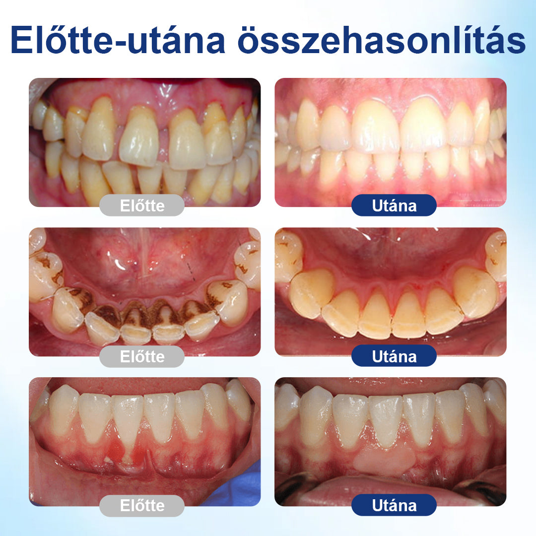 ⭐⭐Laleia® GumViva Szájregeneráló Oldat