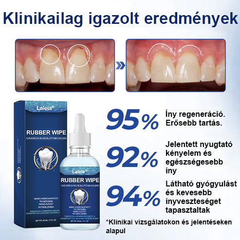 ⭐⭐Laleia® GumViva Szájregeneráló Oldat