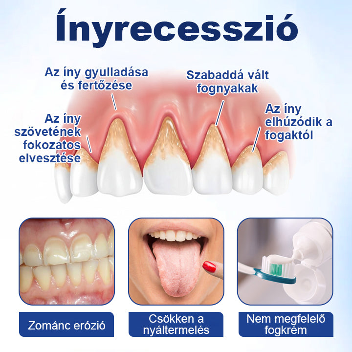 ⭐⭐Laleia® GumViva Szájregeneráló Oldat