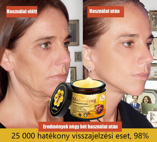 🌿 Bőrgyógyász ajánlása ✨ ZödVita® Méhméreg Bőr Helyreállító Krém 🔥 Magyar fejlesztés, magyarországi gyártás és szállítás